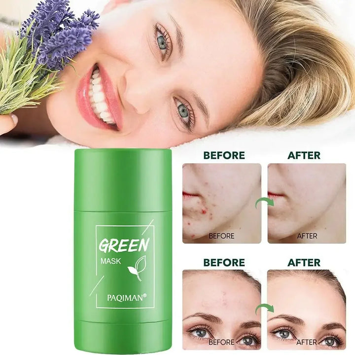 🎁 Buy 1 Get 1 Free! Deep Cleansing Green Tea Mask